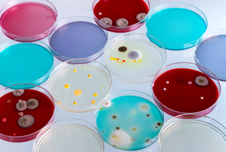 Growth plates in the laboratory / petri dishes in the workbench of labの写真素材