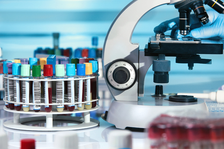 doctor in the lab analyzing in microscope blood test and other samples in the rack / technician...