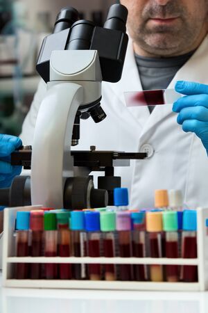 Laboratory technician preparing a blood smear sample to analyze with microscope in the lab / Microscopist holding slide with blood smear for analysis of sample in the laboratoryの写真素材