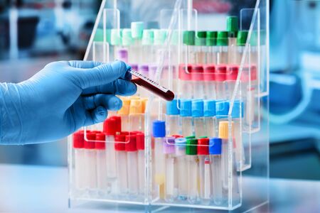 doctor with blood sample to analyze in the preanalytical lab  / technician holding a blood sample tube for analysis in the laboratoryの写真素材