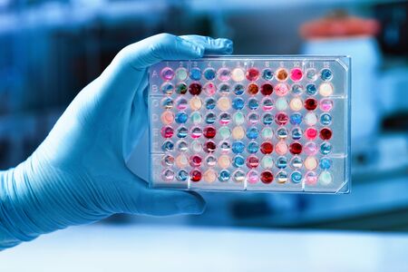 Scientist holding a 96 well plate with samples for analysis / researcher hand holding microplate for...