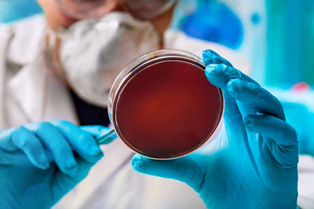 microbiologist working with petri dish for analysis in the microbiology laboratory / lab technician analyzing petri plate in the labの写真素材