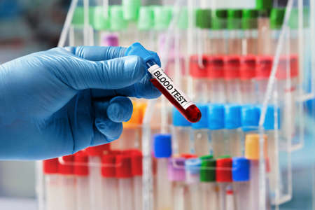 doctor hand taking a blood sample tube from a rack in the laboratory / Technician holding tube with...
