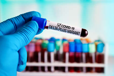 Technician holding tube of blood test identified with the label Covid-19 DELTA Plus Variant. Doctor with a positive blood sample for the new variant detected of the coronavirus strain called DELTA PLUSの写真素材