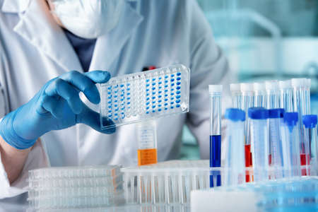 hand of researcher working with microplate for elisa analysis. Doctor working with panel microplate...