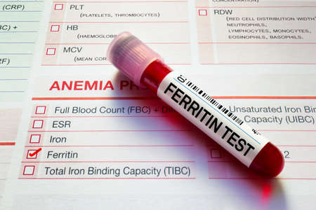 Blood tube test of patient for Ferritin analysis in hematology laboratory. Blood sample over samples requisition form for check of Ferritin in laboratory