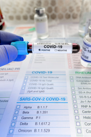 Doctor holding tube of blood sample in the laboratory identified with Positive COVID-19 or...