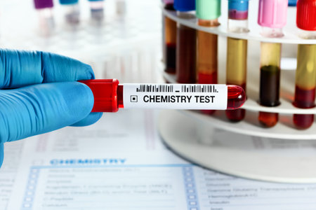 Technician lab holding Blood sample tube for analysis of blood chemistry study in the laboratory. Doctor holding Blood test over requisition report for blood chemistry analysisの写真素材