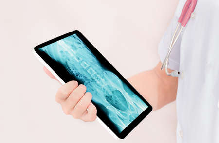 close up doctor holding tablet with x-ray in screenの写真素材