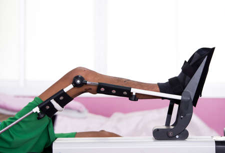 continous motion machine working for increase range of motion of young manの写真素材