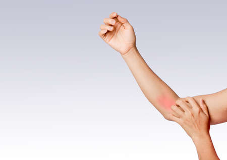 left hand scratching right arm around elbow joint