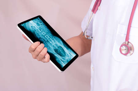 doctor holding tablet and x-ray image in screen and stethoscope neckletの写真素材