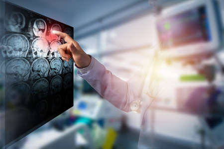 doctor touching computer screen of CT brain image in working room, illustration ECG and light and double exposure with woman doctorの写真素材