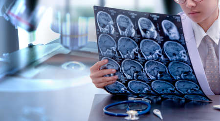 young female doctor holding MRI or CT scan picture, doctor in uniform sitting in working room and holding X-ray picture for diagnosis brain injury or cerebrovascular accident of patientの写真素材