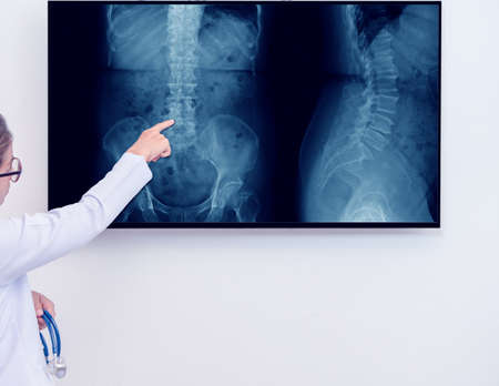 woman doctor pointing index finger to spine x-ray image on monitor