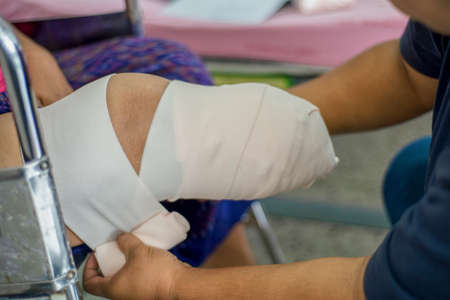 elastic bandaging in diabetes mellitus BK amputationの写真素材