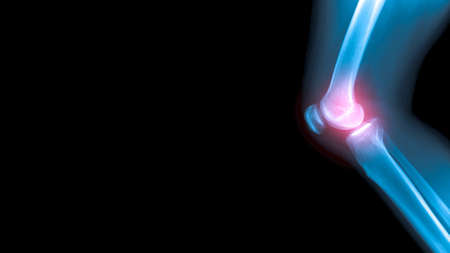 x-ray image OA with banner space on black background の写真素材