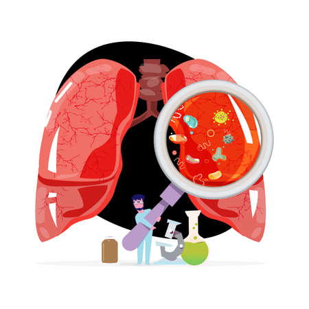 lower respiratory infection - vector illustrationのイラスト素材