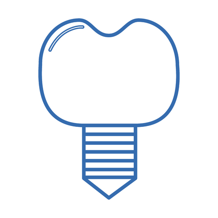 Vector illustration of dental implantのイラスト素材