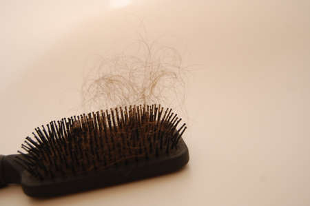 hair lossの写真素材