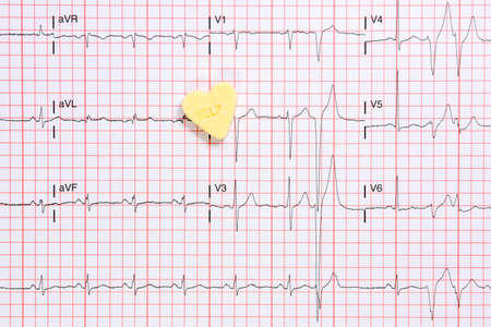 ECG graph, diagnosis heart healthの写真素材