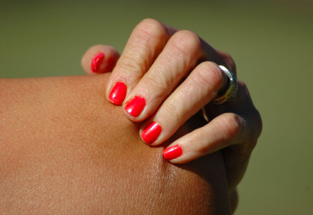 A white female hand of a caucasian woman with red nailpolish on the fingernails holding and scratching the itchy and sore skin of her naked shoulder outdoors because of her sunburnt skin の写真素材