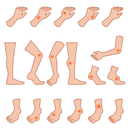 Limbs of goutのイラスト素材