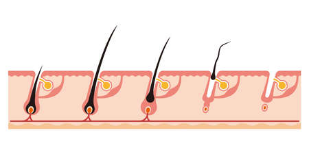 Illustration of a hair cycleのイラスト素材