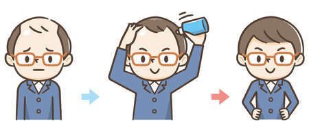 Progress of thinning hair and countermeasuresのイラスト素材