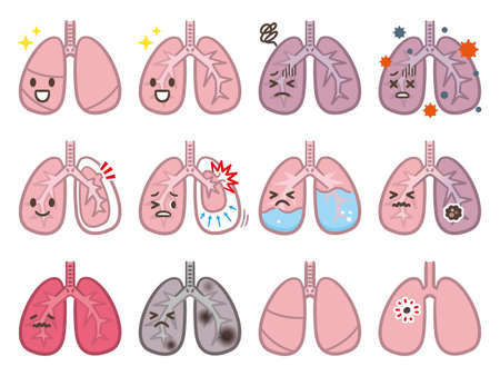 Set of lung disease illustrationsのイラスト素材