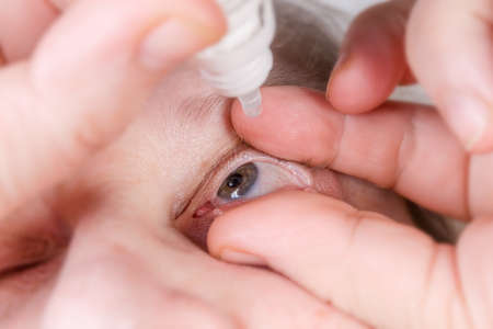 Human gray eye with some blood vessels on sclera during the dripping with eye drops, close-up in selective focusの写真素材