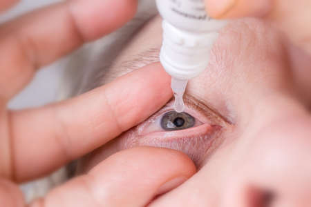 Human eye with some blood vessels on sclera during its dripping with eye drops, close-up in selective focusの写真素材