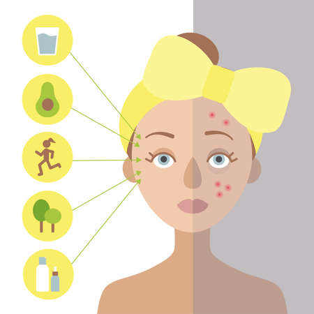 Girl with a yellow bow on her head. It is problematic. On the left circles, for the skin.Flat vectorのイラスト素材