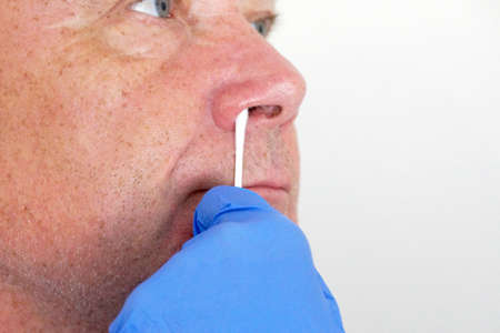 the doctor takes a test for coronavirus from the man's nose close-upの写真素材