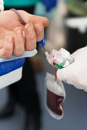 The hand of male donor gives blood in a mobile blood donation center. Blood samples. Hands of the nurse with protective gloves. Donation to support during a pandemia of coronavirus, selective focusの写真素材