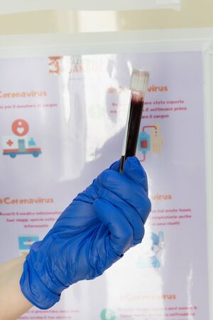 Avetrana, Italy, - Marth 19, 2020. Hand with medical latex glove holding blood sample vial in front of blood test form, Donation to support the hospitals during coronavirus, selective focusの写真素材