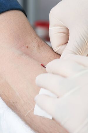 inserts a needle into a vein, close-up, preparation for taking blood test from a vein, mobile blood station. Donation blood to support during a pandemia of coronavirus, World blood donor dayの写真素材