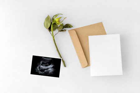 Pregnant Announcement Template.Blank card mockup for baby shower invitation. Layout for the design...