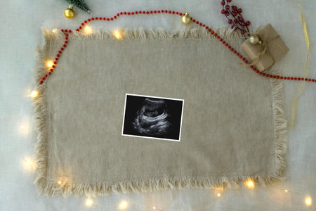 Pregnant Announcement Template.Holiday Digital Pregnancy Announcement. Layout for the design and placement. Onesie template . Mockup of infant bodysuit. Social media Baby Announcement.の写真素材