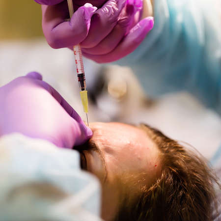 Pretty woman makes standart beauty injections for youth effectの写真素材