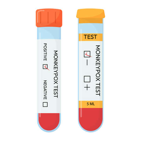 Blood sample tube for Monkeypox virus test. Positive or negative test. Test systems.のイラスト素材