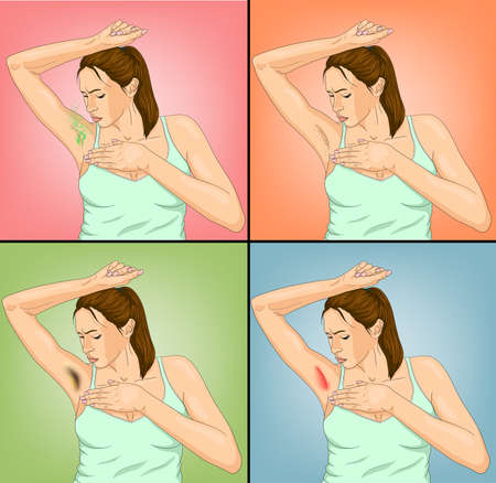 Problems with armpits of a woman