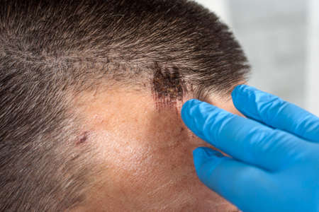 Man with a head wound at the doctor's appointment.