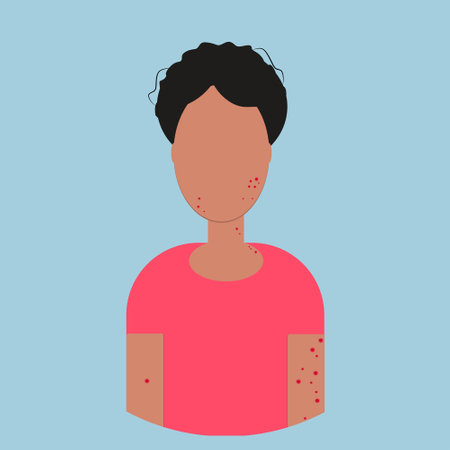 A woman with a rash on her face and body with symptoms of monkeypox virusのイラスト素材