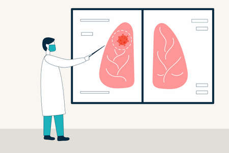A doctor man in a uniform and a medical mask points to an inflammation site on an X-ray of the lungs. Viral pneumoniaのイラスト素材