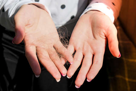 Female hand holding lost hair. Alopecia hair loss treatment concept, hair fall everyday serious problem. Solutions for hairloss.の写真素材