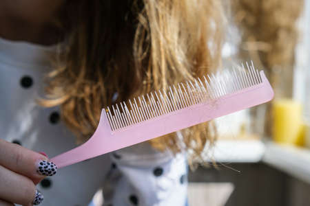 Worried woman holding brush with hair loss after brushing. Clump of hair, problem of growth, hair care problems.の写真素材