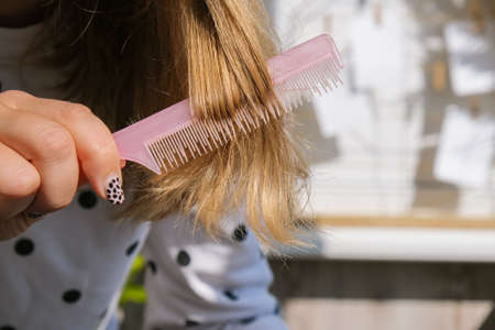 Worried woman holding brush with hair loss after brushing. Clump of hair, problem of growth, hair care problems. Seasonal hair lossの写真素材