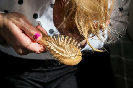 Hand holds bunch of hair on the comb. Hair loss concept. Female seasonal hair loss problems. Alopecia hair loss treatment. Solutions for hairlossの写真素材