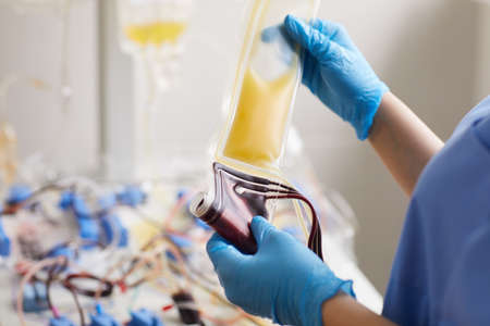 Close-up of nurse in protective gloves holding dropper with medicine and blood samples she working at the labの写真素材
